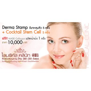 รักษาหลุมสิว ด้วย Derma stamp