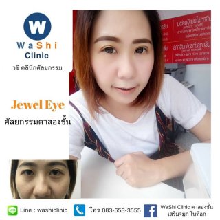 บริการรักษาจุดด่างดำ